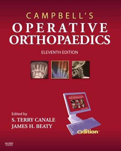 Campbell's Operative Orthopaedics